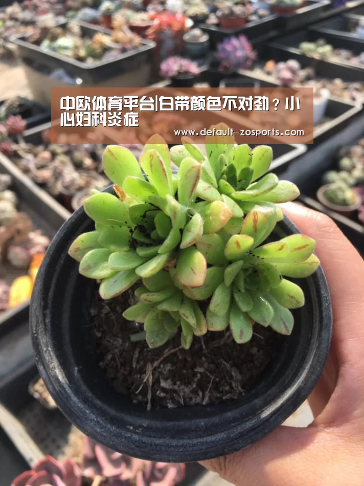中欧体育平台|白带颜色不对劲?小心妇科炎症(图4) 中欧体育